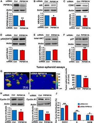 PIP5K1α is Required for Promoting Tumor Progression in Castration-Resistant Prostate Cancer